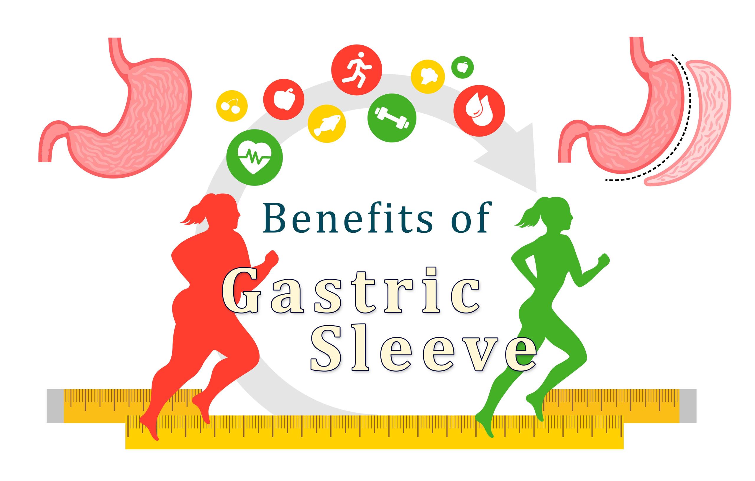 Benefits of Gastric Sleeve Surgery - Effective Weight Loss, Improved Health, and Enhanced Quality of Life