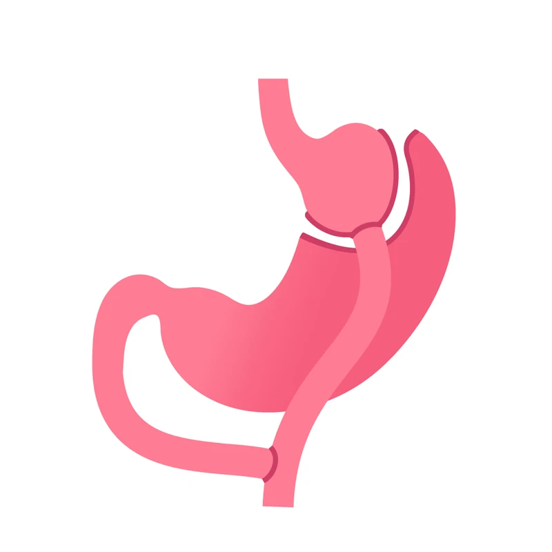 Gastric bypass surgery diagram showing stomach pouch and rerouted small intestine