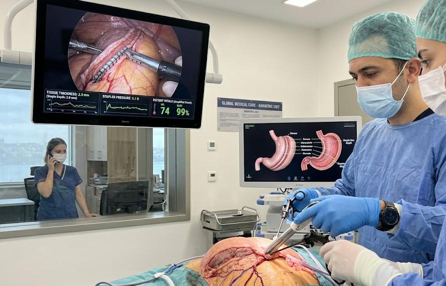 How Painful is Gastric Sleeve Surgery