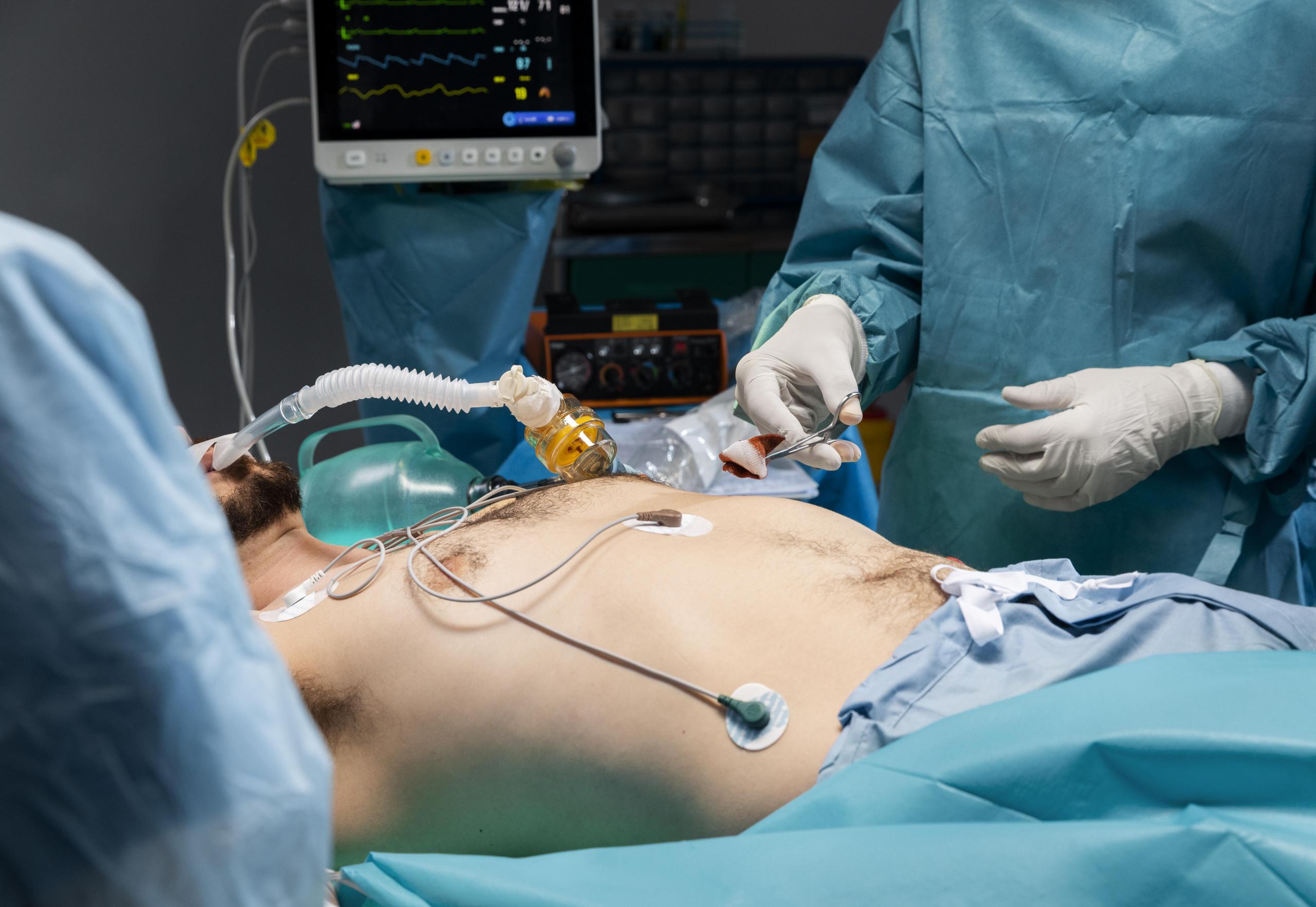 Gastric Balloon Procedure