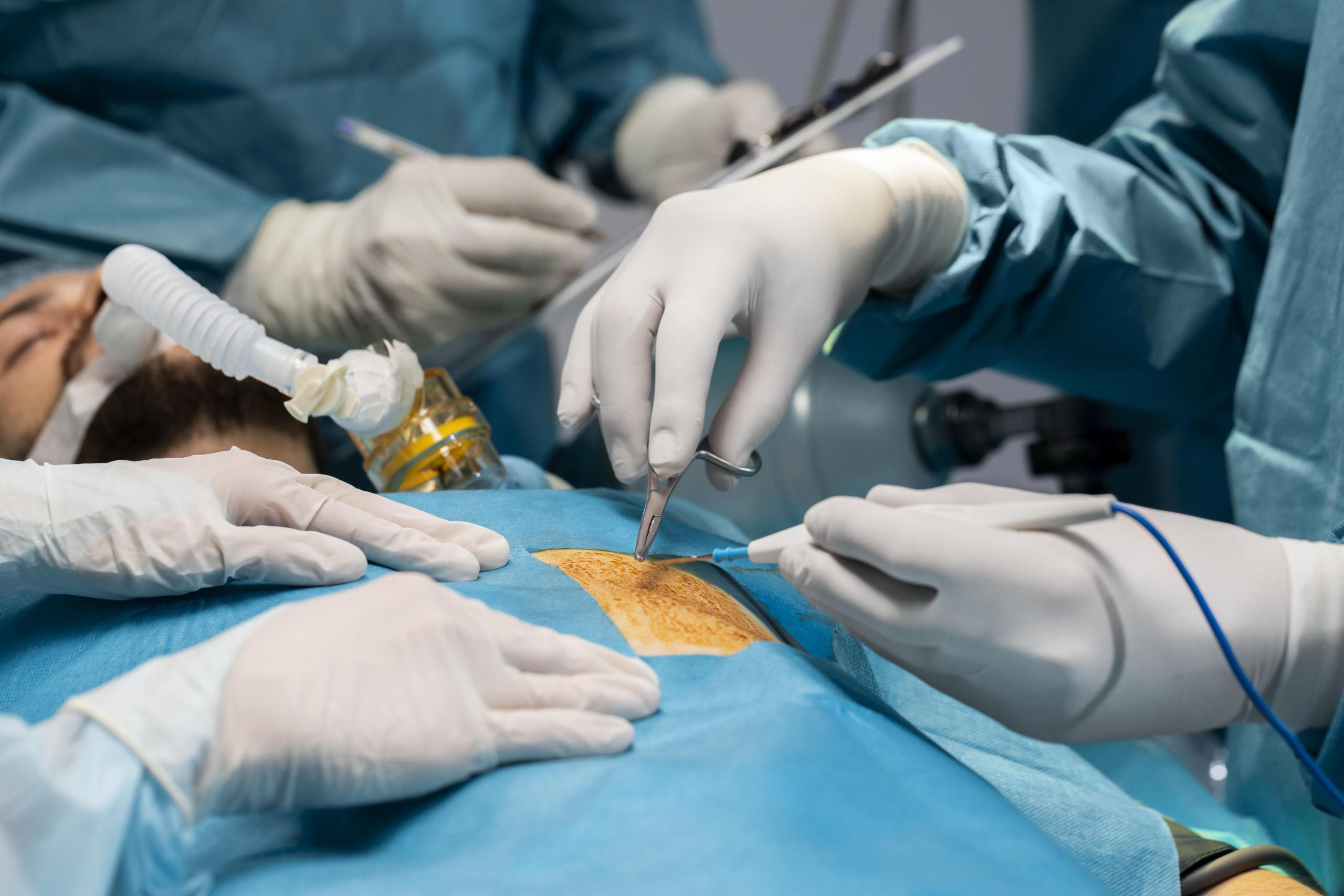types of weight loss surgery